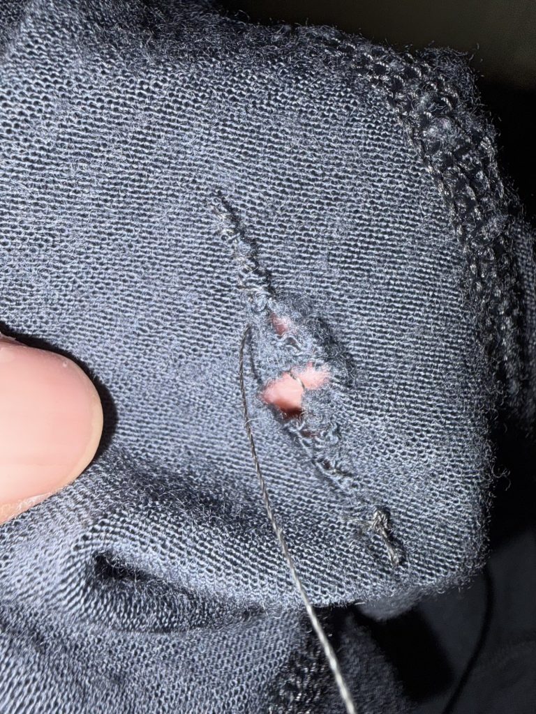 Photo of a large hole being mended. 