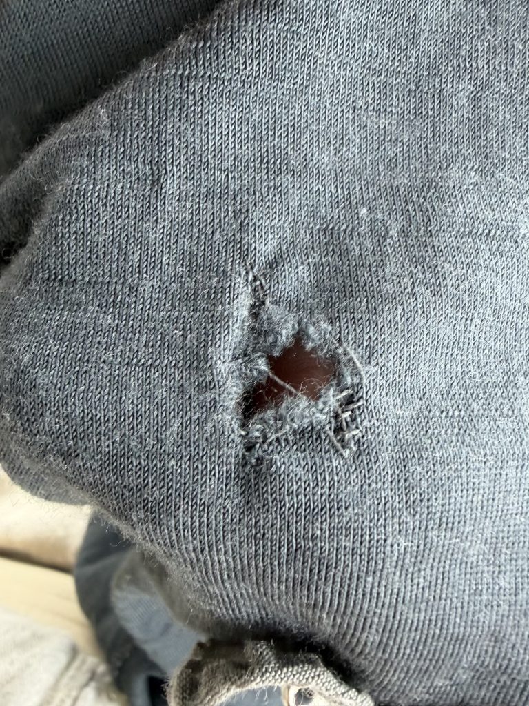 Photo of a large moth hole in a wool shirt. 